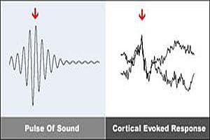 Brain Entrainment Cortival Evoked Response diagram