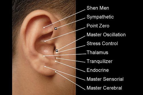 Ear Acupuncture master points