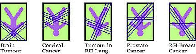 Geopathic Stress Radiation effects upon your health